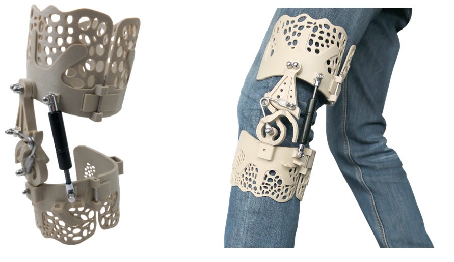 3D打印超輕型PEEK膝蓋支架 保護(hù)提高行走能力